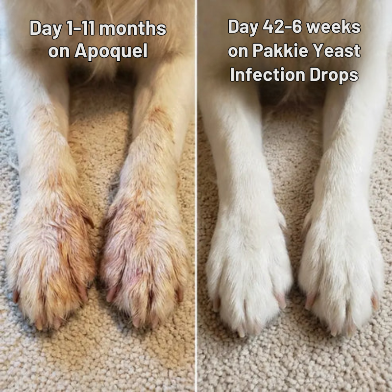 Yeast Infection Drops™
